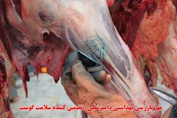 نظارت بهداشتی 